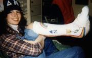 Delta Nu sister with leg in a cast, c.1985